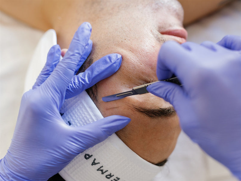 DermaplanePro - Dermaplaning 1