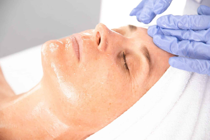 Client with eyes closed. Esthetician wearing latex gloves is using NuPeel on the client and the loosened skin is beading up.