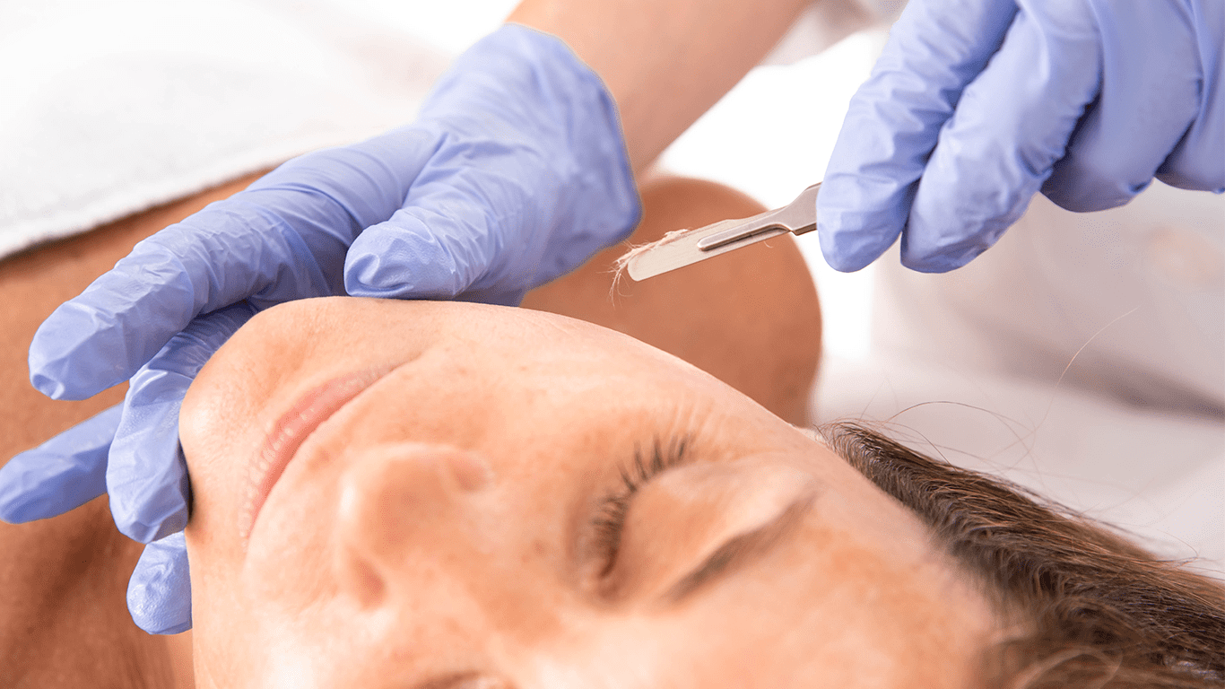 Dermaplane blade showing the peach fuzz that was taken off the client's face.
