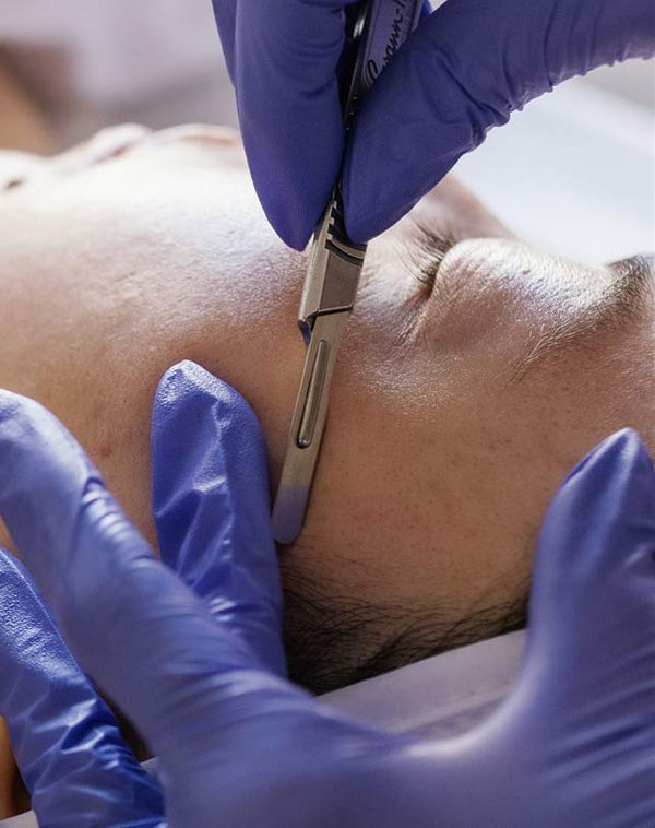 DermaplanePro medical-grade dermaplaning blades